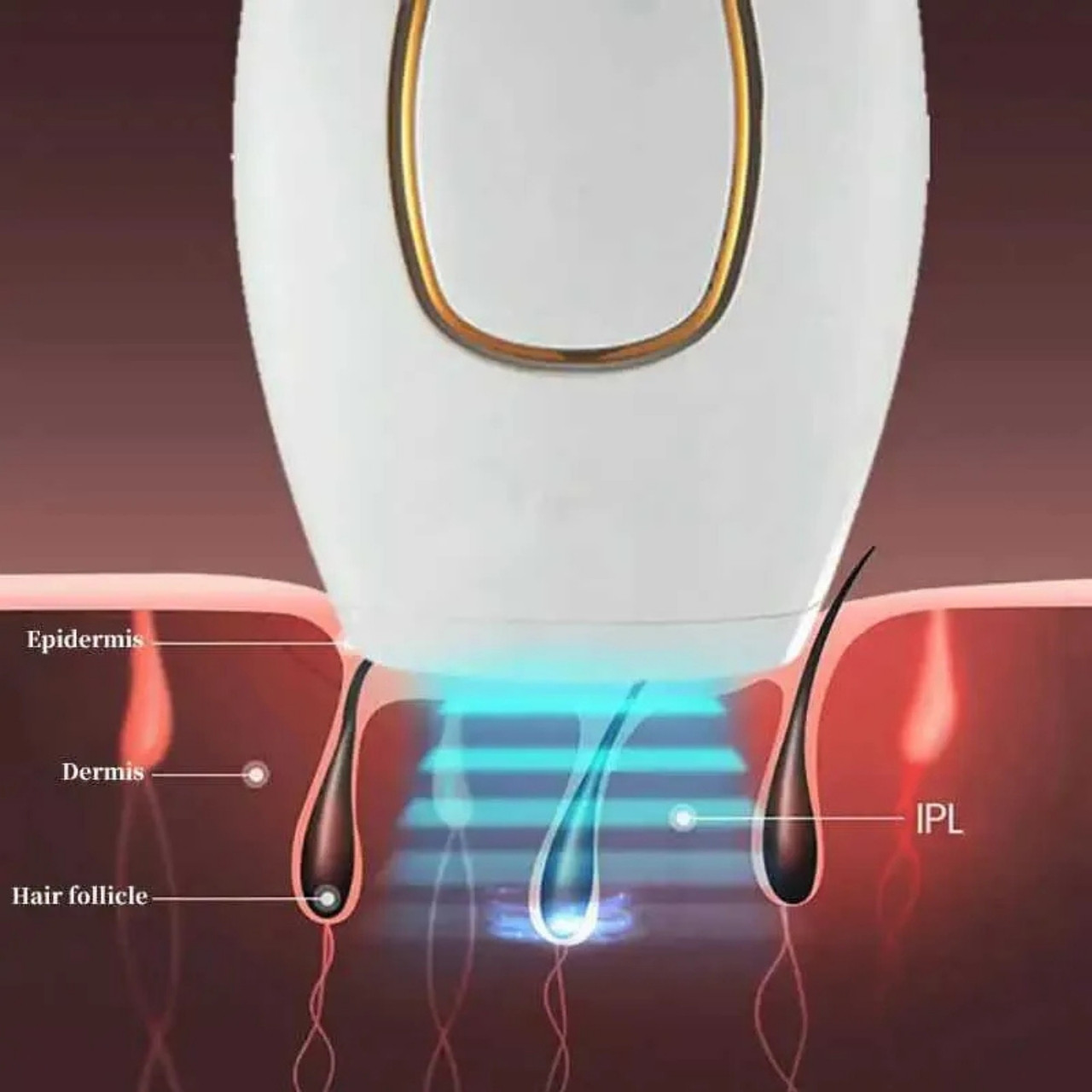 IPLStar, zařízení na odstranění chloupků pomocí laseru - Image 9