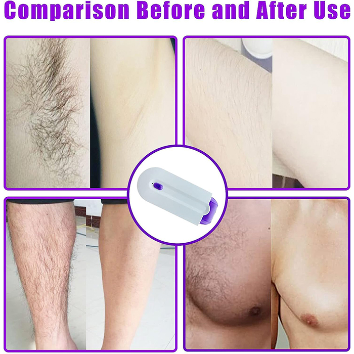 SmoothTouch, mikrofoliový holicí strojek pro ženy - Image 7